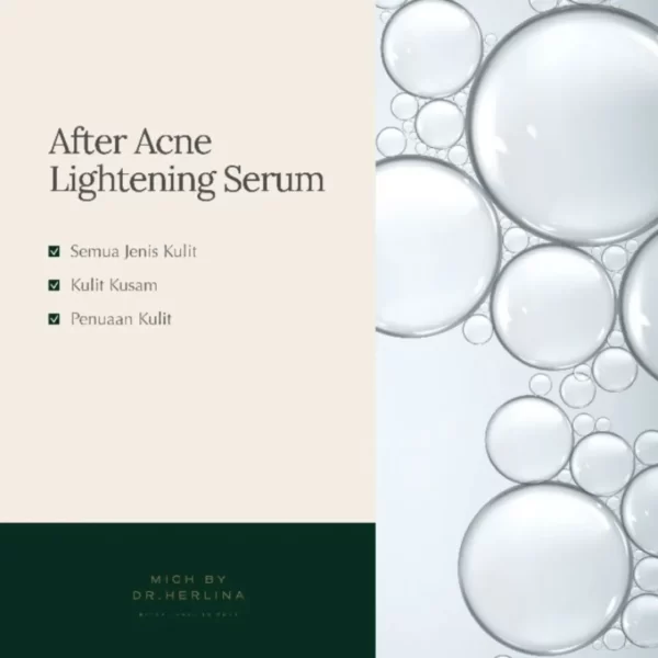 mich after acne lightening serum